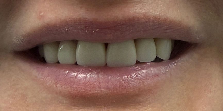 Smile Gallery
